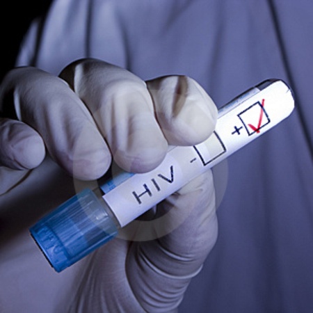 HIV test